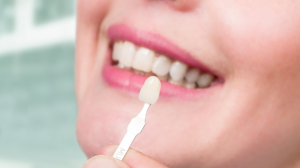 Lente de contato dental: Quanto tempo dura?