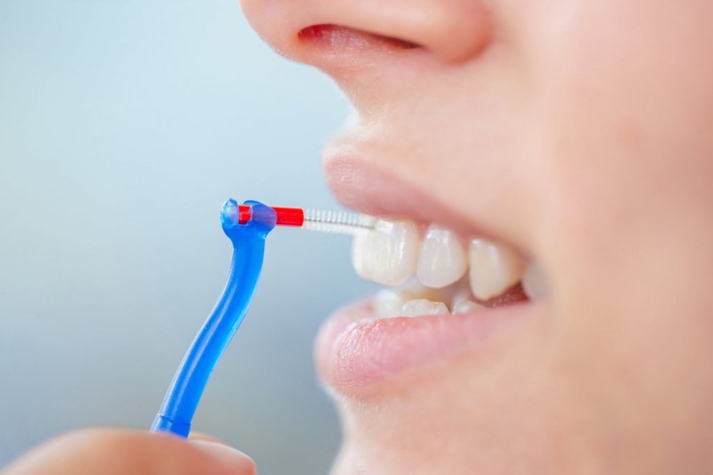 Escova interdental: sabia que ela vai além do aparelho? « GOU