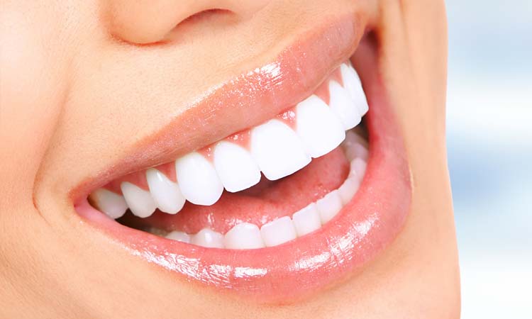 Sorriso branco após clareamento dental